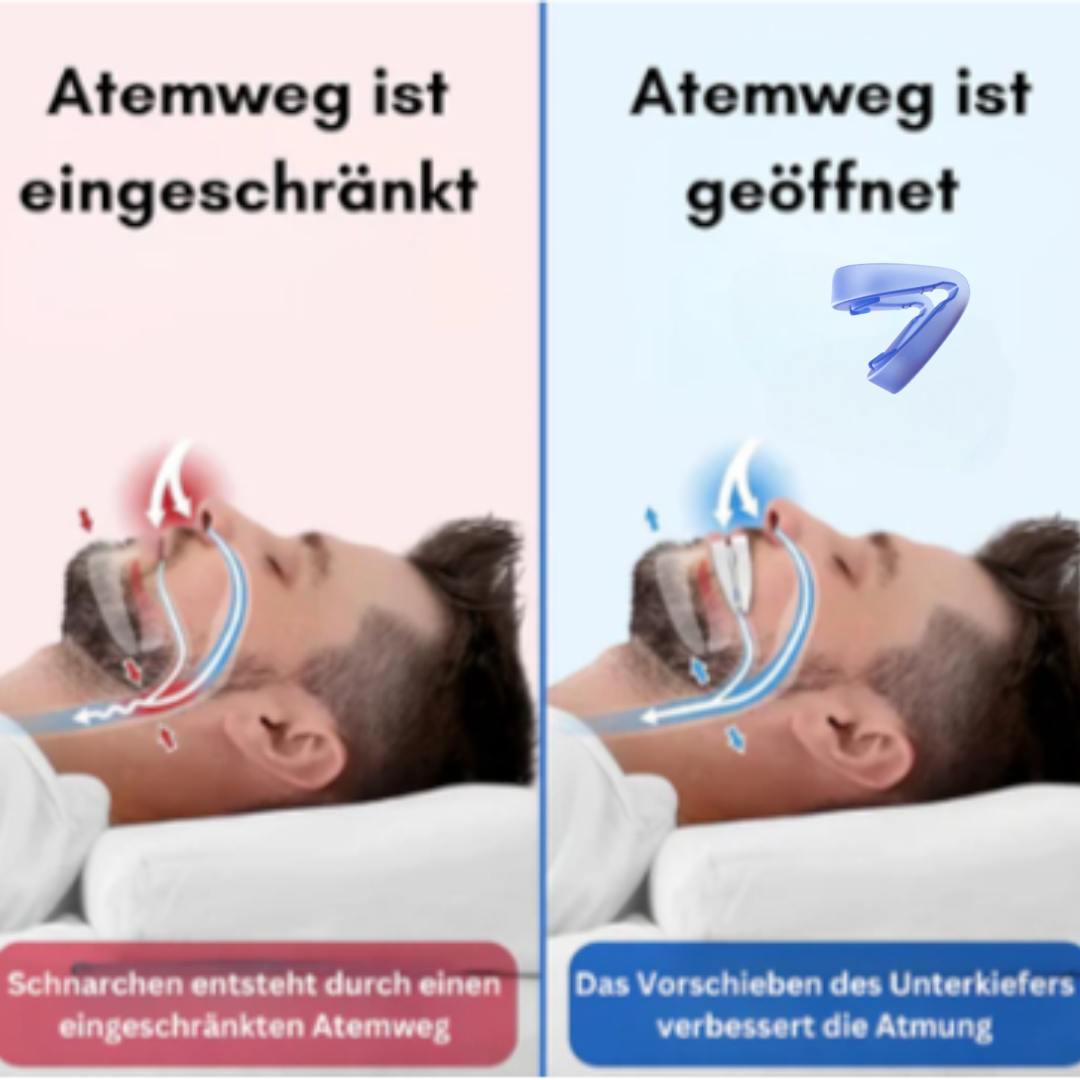 Anti Schnarch Schiene