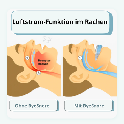 Anti Schnarch Schiene